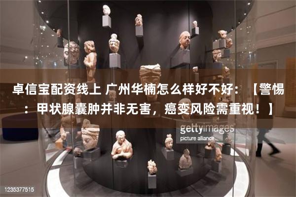 卓信宝配资线上 广州华楠怎么样好不好：【警惕：甲状腺囊肿并非无害，癌变风险需重视！】